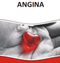Angina
